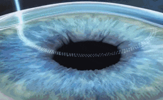 2.gif